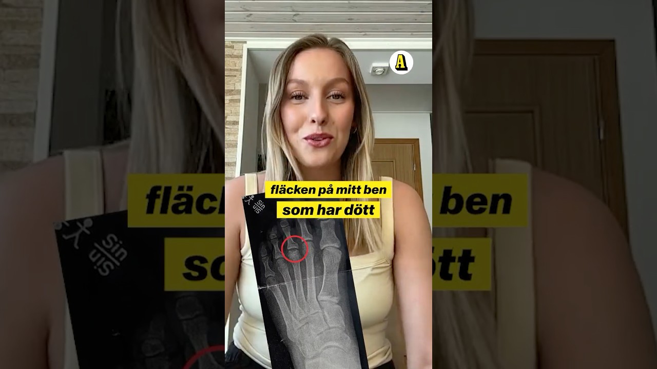 Adlaines fot har dött: ”Red flag”