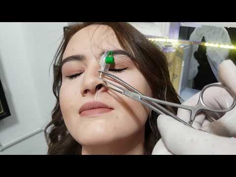 Video: Septum (Burun Kıkırdak Duvarı) Piercing Nasıl Yapılır (Resimli)