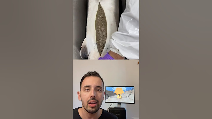 Τι είναι το χαβιάρι;🤢 #shorts