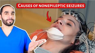 Causes of Nonepileptic Seizures (PNES). Hint, NOT Stress!