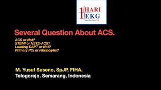ACS or Not STEMI, Subtle STEMI, NSTE-ACS or Occlusion MI Loading DAPT or Not Primary PCI or .