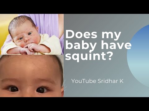 Video: Heeft mijn baby scheel?