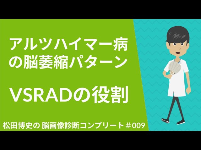 松田博史の脳画像診断コンプリート#009「アルツハイマー病診断