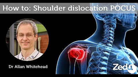 How to: Shoulder dislocation ultrasound  - Zedu PO...