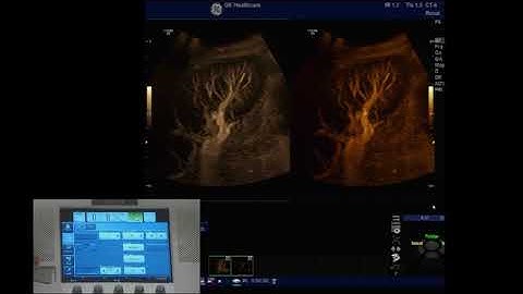 LOGIQ E9 B Flow Technology