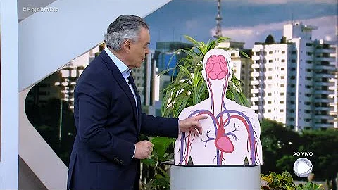Como fica o cérebro depois do AVC?