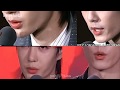【bjyx】why are their lips swollen after interval？