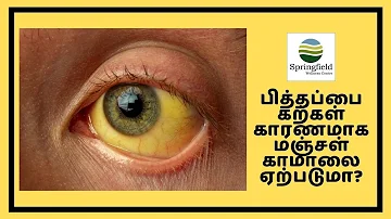 பித்தப்பை கற்கள் காரணமாக மஞ்சள் காமாலை ஏற்படுமா? Jaundice due to Gallstones in Gallbladder in Tamil