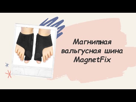 MAGNETFIX РЕАЛЬНЫЕ ОТЗЫВЫ ШИНА MAGNETFOX МАГНИТНАЯ ВАЛЬГУСНАЯ