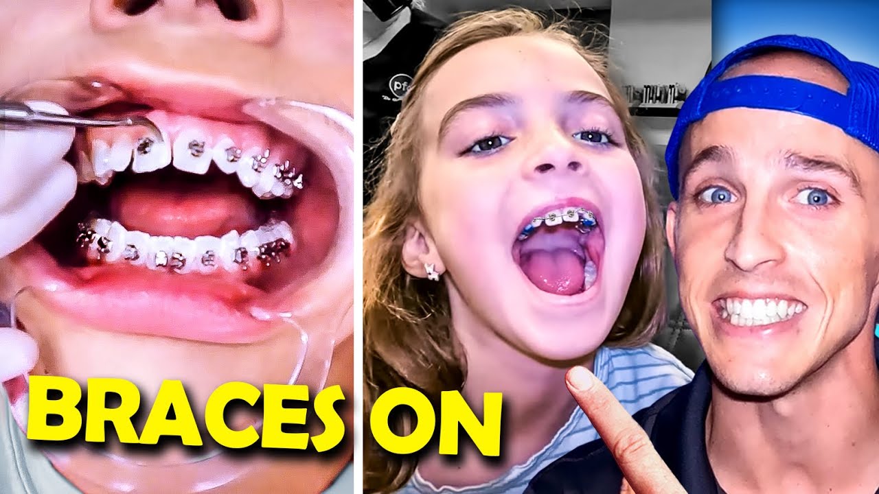 Getting braces...? 3 Questions you ask before you start orthodontic