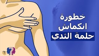 انكماش حلمة الثدي.. هل هو أمر طبيعي؟ متى يكون خطيراً؟!!