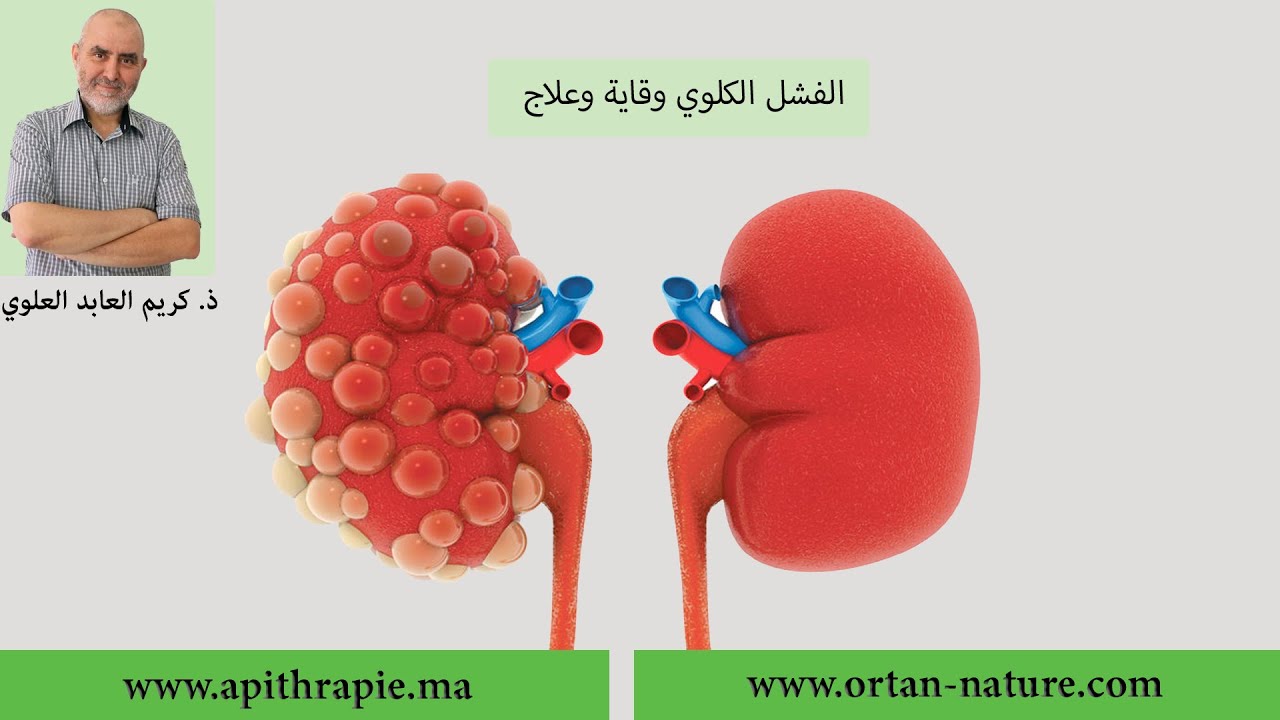 الباحث كريم العابد العلوي: الفشل الكلوي وقاية وعلاج