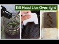 Homemade Hair OIL for Lice & Nits Removal | KILL HEAD LICE & NITS Overnight  | Sushmita's Diaries