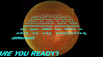 MAKULA DEJENERASYONU TOPCON DRI TRITON PLUS OCT ANJIYOGRAFI  PROF YETIK