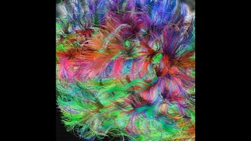 How Training Can Help You Thrive with a Highly Sensitive Nervous System