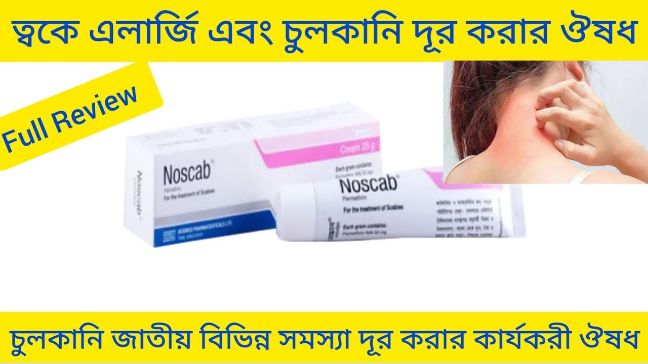 Noscab Cream Bangla/ ত্বকে এলার্জি চুলকানি দূর করার ঔষধ/ Noscab Cream