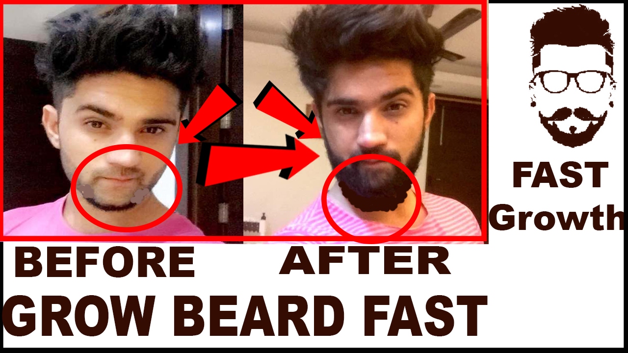 How to Grow Beard fast 100% | Beard Growth Tips in Hindi + English | India  - thptnganamst.edu.vn