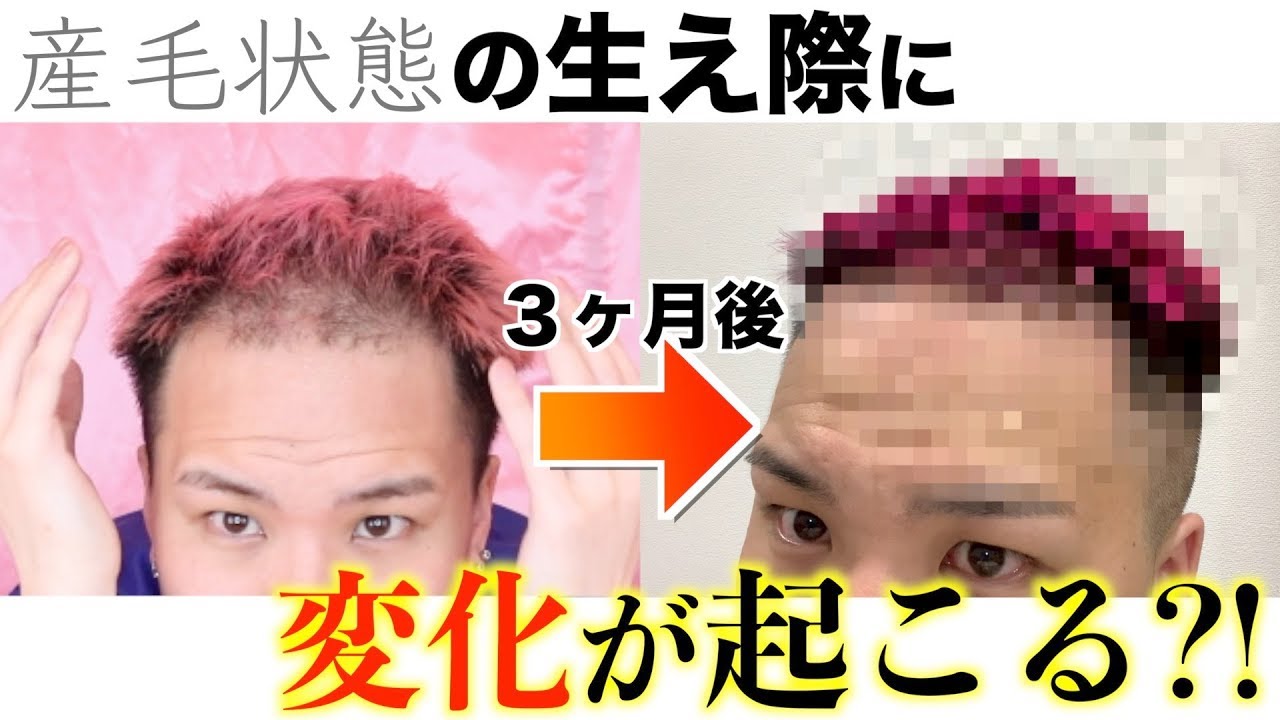 バイタル 男性 アデノ 使い方