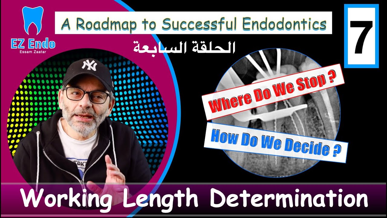 الحلقة السابعة من تحضير القنوات Root Length Determination