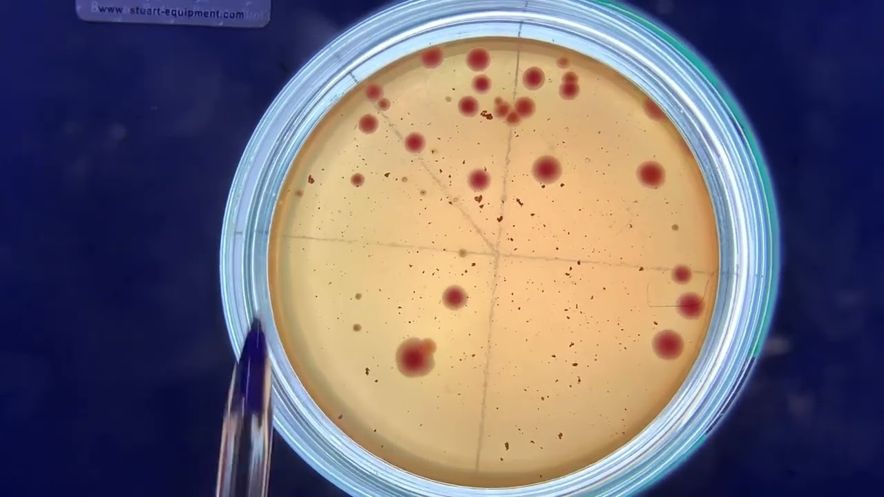 Comment faire le dénombrement des colonies lors de l’analyse microbiologique des aliments ou boisson