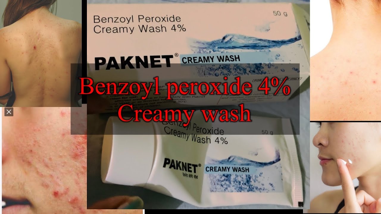 creamy wash uses in Hindi side effects 🥵doses benzoyl