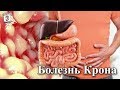 "На приеме у врача" Выпуск 62 - Болезнь Крона