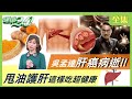 吳孟達肝癌病逝 糖尿病是高危險群！甩油護肝這樣吃超健康！ 健康2.0 20210313 (完整版)