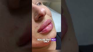 This girl thought an insect had bitten her lip while she was sleeping. But what the doctors...