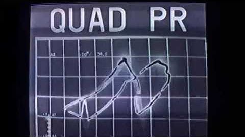 Bertolt Meyer - Ragetrick (Electrigger and Theiler Remix)