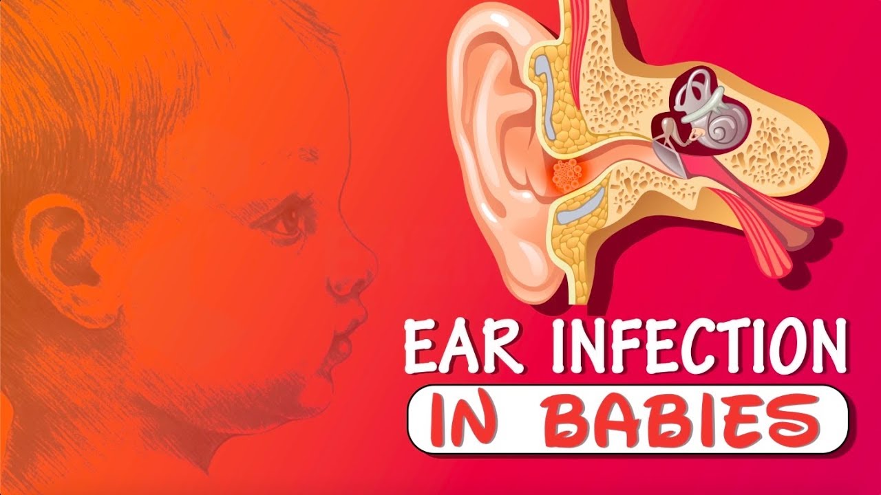 Does My Baby Have an Ear Infection? YouTube