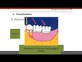 prótesis parcial removible, secuencia clínica, tipos de PPR