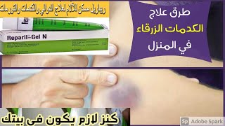 علاج التورم الناتج عن الكدمات او كلكعة وتورم الحقن تحت الجلد😬 لكل اللى اخد حقنه غلط💉 ومكانها وارم  😬