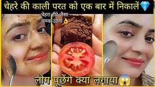 Instant Brightening|चेहरे की काली परत को निकाल फेशियल से20 गुना ज्यादा निखार चाहिए तो इसे लगाओ