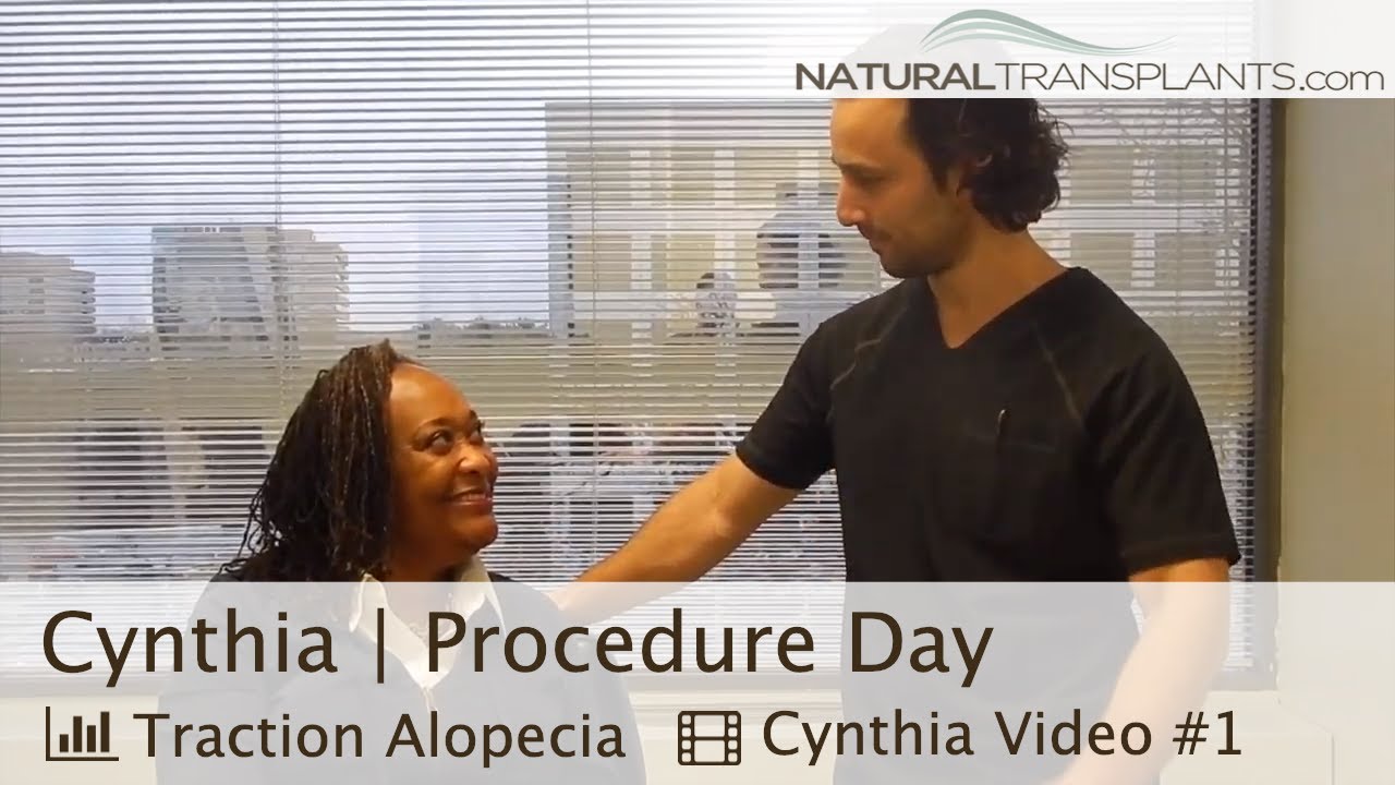 fue hair transplant month by month Traction Alopecia Treatment | Traction Alopecia Edges Procedure with Dr Kevin Blumenthal (Cynthia)