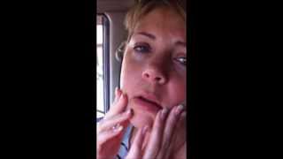 Wisdom Teeth Aftermath, Chipmunk Vampire