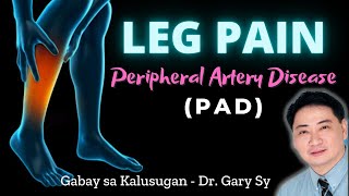 Leg Pain: Peripheral Artery Disease (PAD)  Dr. Gary Sy