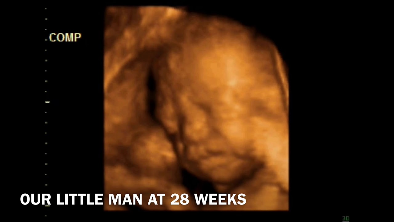 3D ULTRASOUND 28 WEEKS PREGNANT BABY BOY YouTube