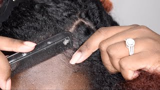 ITCHY DRY SCALP | SCRATCHING DANDRUFF | RAKING SCALP