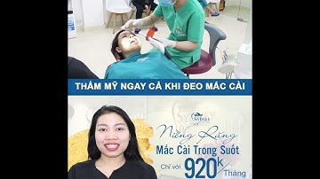 Lợi ích của niềng răng mắc cài pha lê