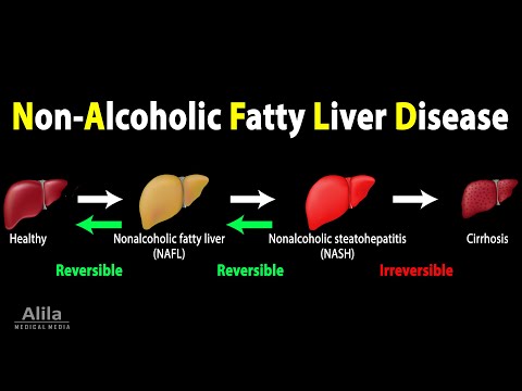 Vídeo: El nafld causa fatiga?