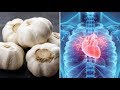5 Miracle Cures of Garlic That Will Surprise You - Benefits Of Garlic For Your Health