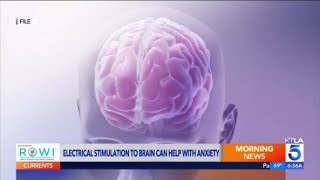Brain stimulation reduces social anxiety study finds