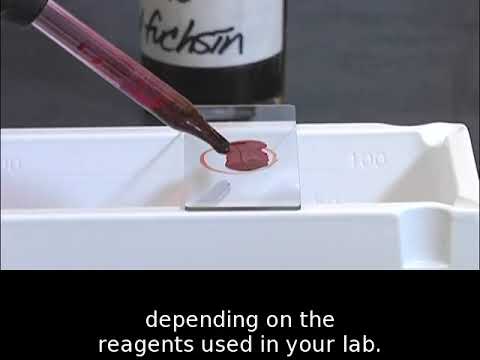 Staining technique in microbiology: Acid fast staining