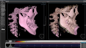 [CYBERMED] OnDemand3D