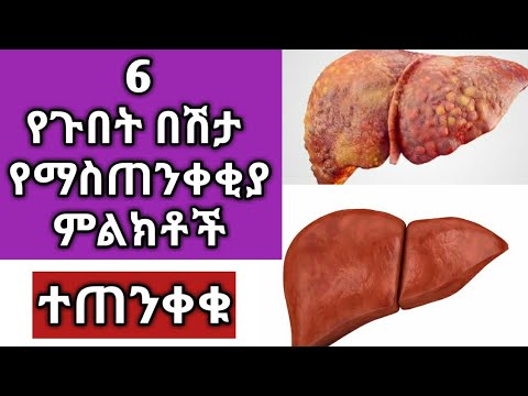 ቪዲዮ: አጠቃላይ መግለጫ እና ዋና የVVG ሽቦ አይነቶች