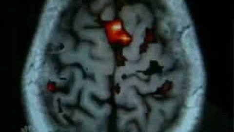 NBC News, thought-controlled robots