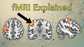 fMRI (Functional Magnetic Resonance Imaging) Explained