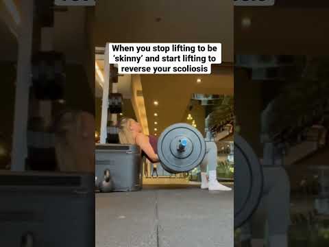 Is reversing scoliosis