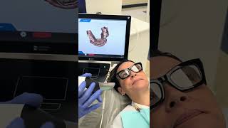 Digital Scan using Cerec Primescan
