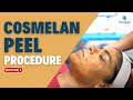 Cosmelan peel treatment  all about cosmelan peel  antiageing treatment delhi  skinqure